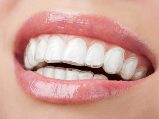 Clínica Dental Doctor Marqués, Implantes dentales y Ortodoncia Invisible